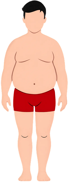 Exemplo de obeso masculino
