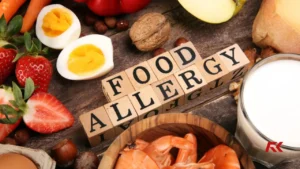 Alergia Alimentar